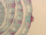 MISSING THUMBNAIL